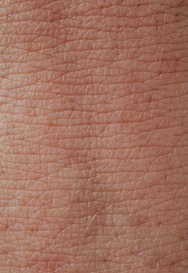 Skin infections can be treated safely by an online Dermatology GP