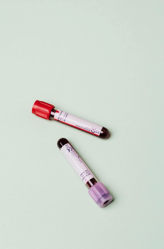 Winter Health Check: Which Blood Tests Should You Consider?